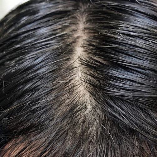 Part line before the protocol: a wide part with scalp clearly visible along it.